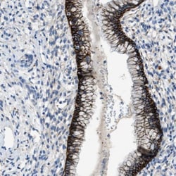 FPRP/PTGFRN Antibody, Novus Biologicals 25 &mu;L; Unlabeled:Antibodies,